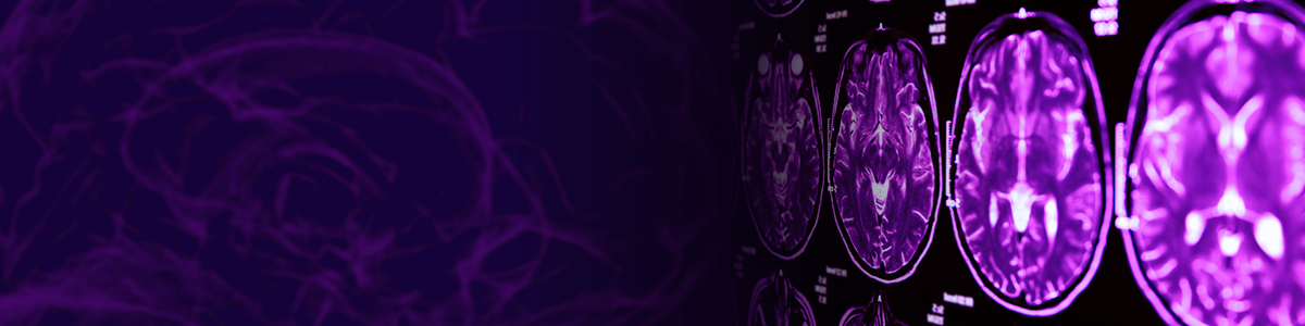 Banner_Ataxia
